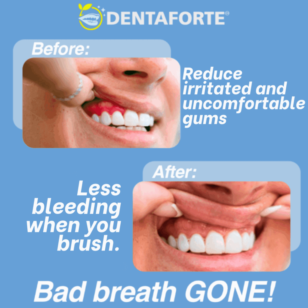 DENTAFORTE™