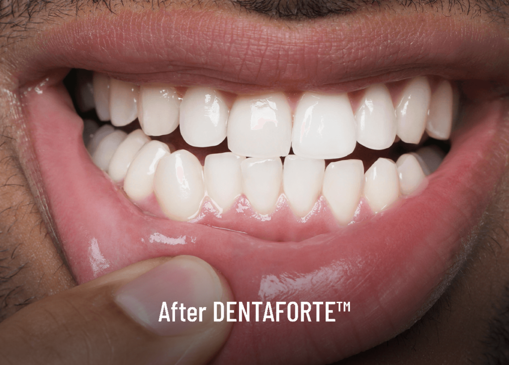 DENTAFORTE™